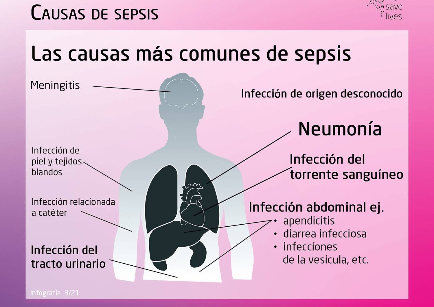Día Mundial de la Sepsis: un alerta a equipos de salud y a la sociedad